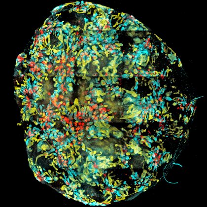 A mini-kidney formed in a dish from human induced pluripotent stem cells. The three colours show the presence of distinct cell types within the developing nephrons. Image: Minoru Takasato